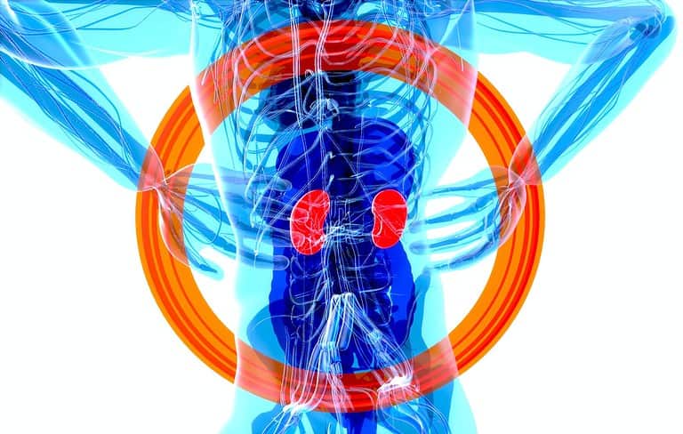 Can Red Light Therapy Help Kidney Stones? Know the Benefits!