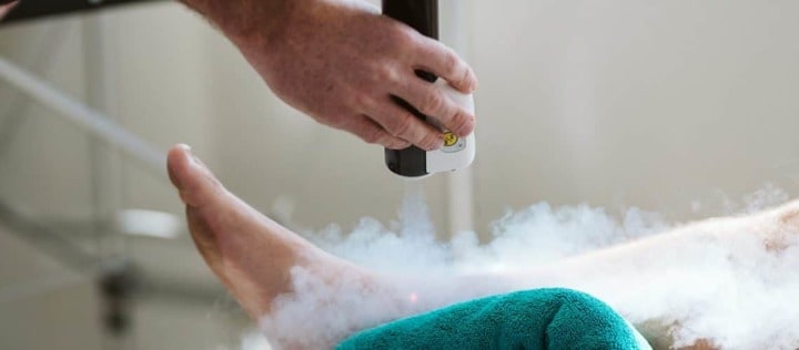 cryotherapy at home kit